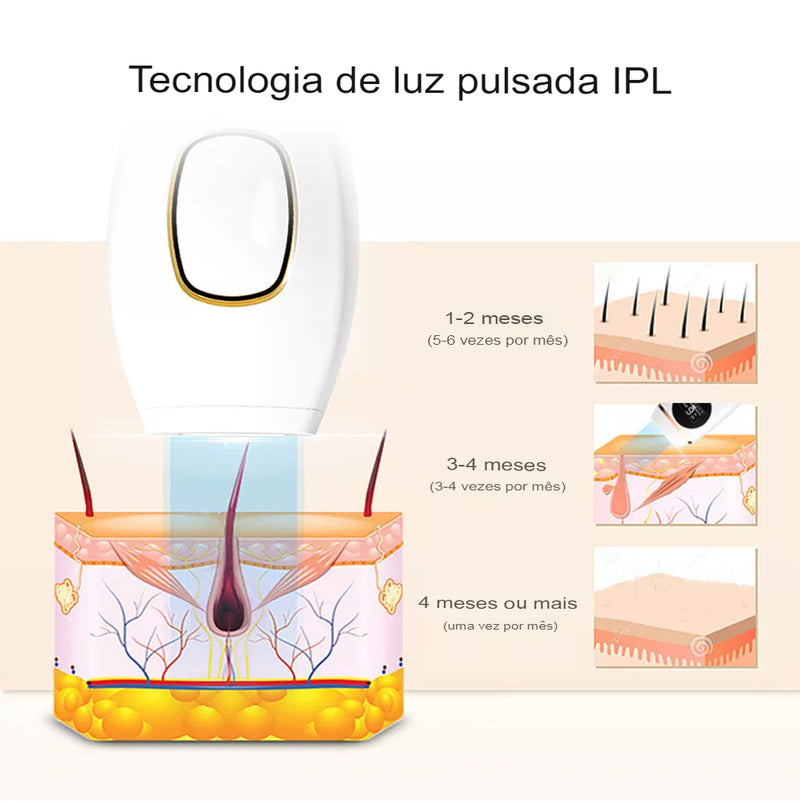 DEPILADOR A LASER – FEMININO